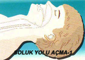 Soluk Yolu Açma-1