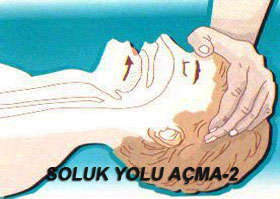 Soluk Yolu Açma-2